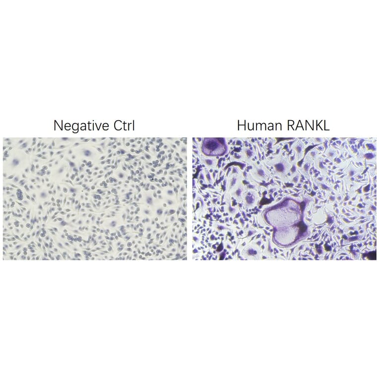 ICC - Recombinant Human RANKL Protein (N-terminal His Tag) (A331210) - Antibodies.com