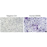 ICC - Recombinant Human RANKL Protein (N-terminal His Tag) (A331210) - Antibodies.com