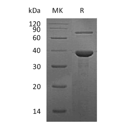 SDS-PAGE - Recombinant Human RBP3 Protein (N-terminal His Tag) (A331212) - Antibodies.com