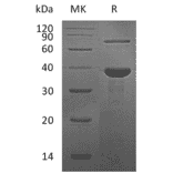 SDS-PAGE - Recombinant Human RBP3 Protein (N-terminal His Tag) (A331212) - Antibodies.com