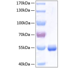 SDS-PAGE - Recombinant Human RBP4 Protein (C-terminal Human Fc and His Tag) (A331213) - Antibodies.com