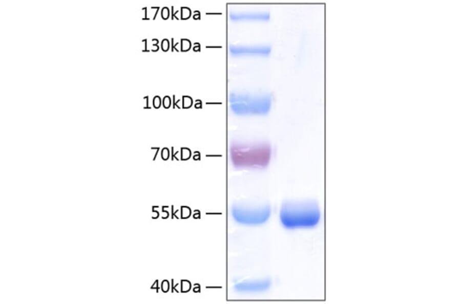 SDS-PAGE - Recombinant Human RBP4 Protein (C-terminal Human Fc and His Tag) (A331213) - Antibodies.com
