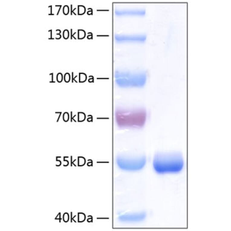 SDS-PAGE - Recombinant Human RBP4 Protein (C-terminal Human Fc and His Tag) (A331213) - Antibodies.com