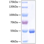 SDS-PAGE - Recombinant Human RBP4 Protein (C-terminal Human Fc and His Tag) (A331213) - Antibodies.com