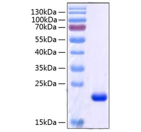 SDS-PAGE - Recombinant Human RBP4 Protein (C-terminal His Tag) (A331214) - Antibodies.com