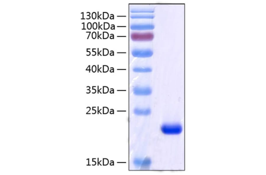 SDS-PAGE - Recombinant Human RBP4 Protein (C-terminal His Tag) (A331214) - Antibodies.com