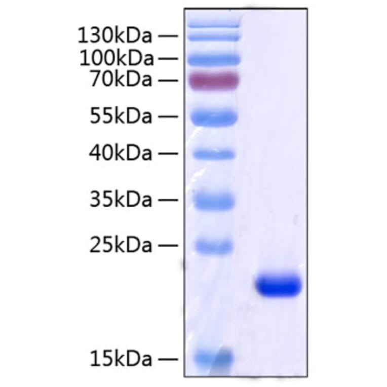 SDS-PAGE - Recombinant Human RBP4 Protein (C-terminal His Tag) (A331214) - Antibodies.com