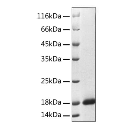 SDS-PAGE - Recombinant Human Reg3A Protein (C-terminal His Tag) (A331215) - Antibodies.com