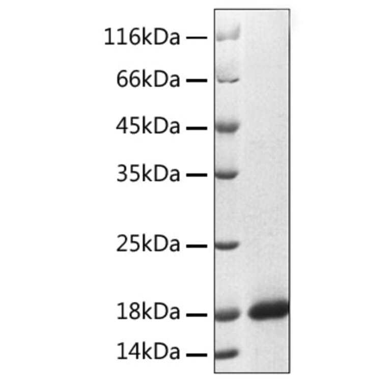 SDS-PAGE - Recombinant Human Reg3A Protein (C-terminal His Tag) (A331215) - Antibodies.com