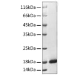 SDS-PAGE - Recombinant Human Reg3A Protein (C-terminal His Tag) (A331215) - Antibodies.com