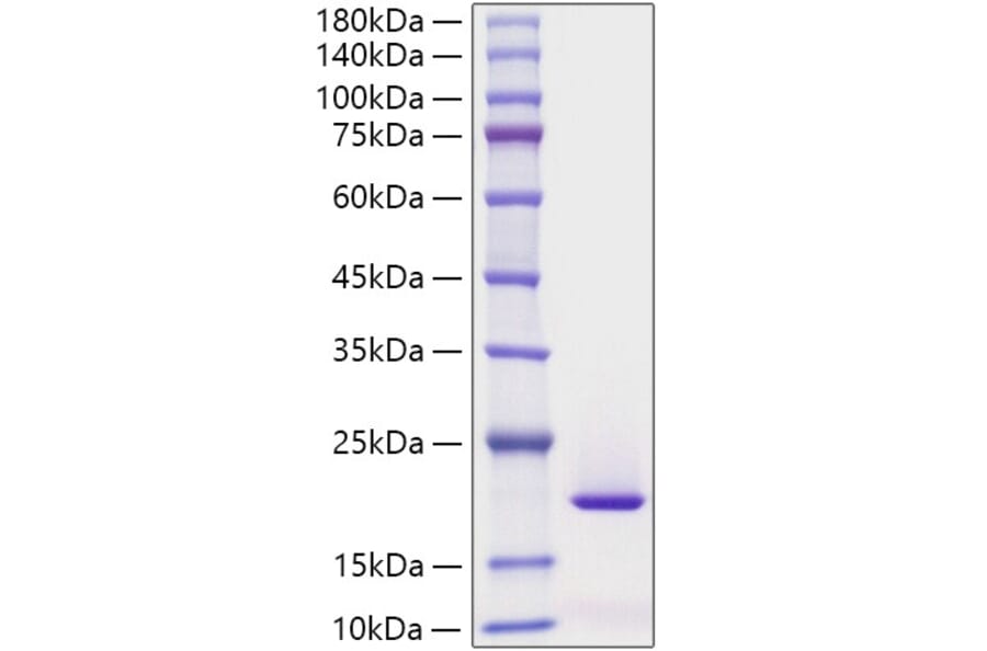 SDS-PAGE - Recombinant Human Reg3G Protein (C-terminal His Tag) (A331216) - Antibodies.com