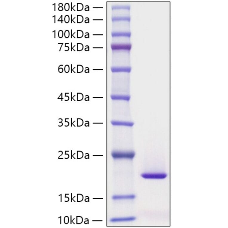 SDS-PAGE - Recombinant Human Reg3G Protein (C-terminal His Tag) (A331216) - Antibodies.com
