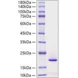 SDS-PAGE - Recombinant Human Reg3G Protein (C-terminal His Tag) (A331216) - Antibodies.com
