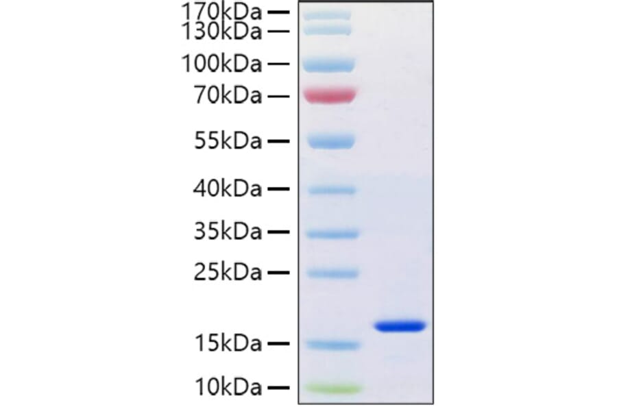 SDS-PAGE - Recombinant Human Reg4 Protein (C-terminal His Tag) (A331217) - Antibodies.com