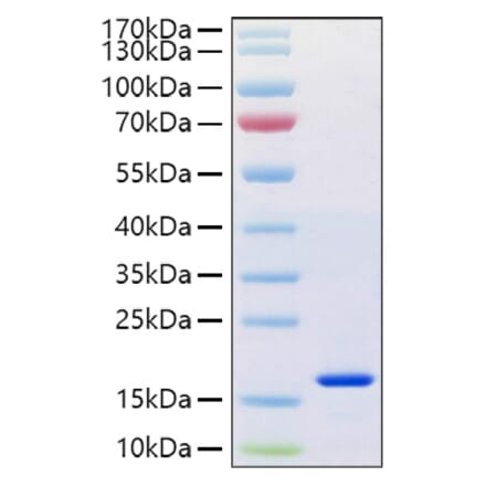 SDS-PAGE - Recombinant Human Reg4 Protein (C-terminal His Tag) (A331217) - Antibodies.com