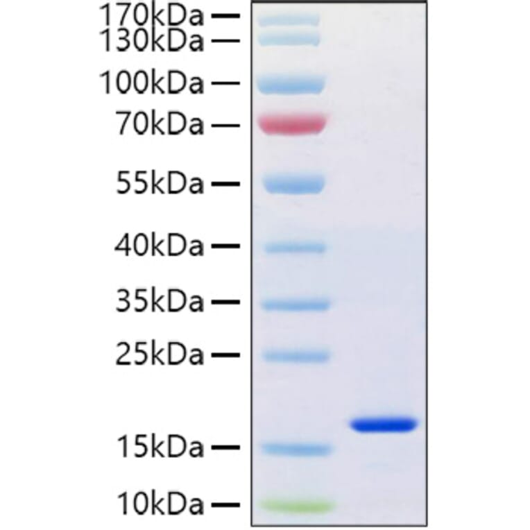 SDS-PAGE - Recombinant Human Reg4 Protein (C-terminal His Tag) (A331217) - Antibodies.com
