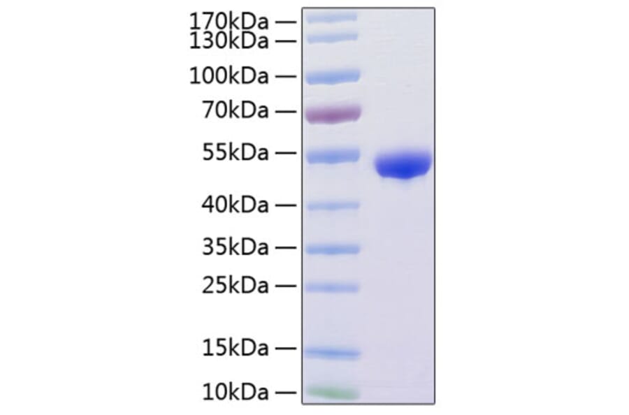 SDS-PAGE - Recombinant Human Renin Protein (C-terminal His Tag) (A331218) - Antibodies.com