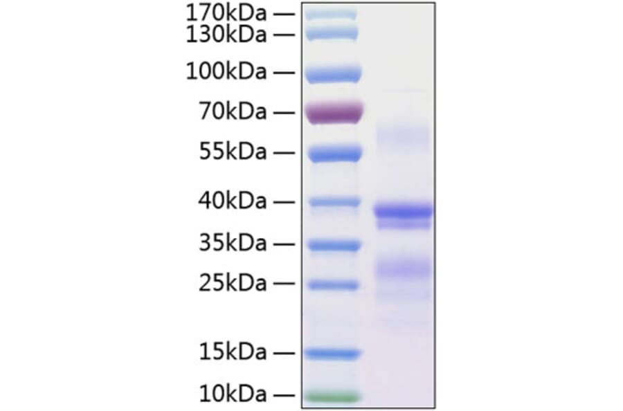 SDS-PAGE - Recombinant Human Repulsive Guidance Molecule A Protein (C-terminal His Tag) (A331219) - Antibodies.com