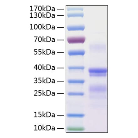 SDS-PAGE - Recombinant Human Repulsive Guidance Molecule A Protein (C-terminal His Tag) (A331219) - Antibodies.com