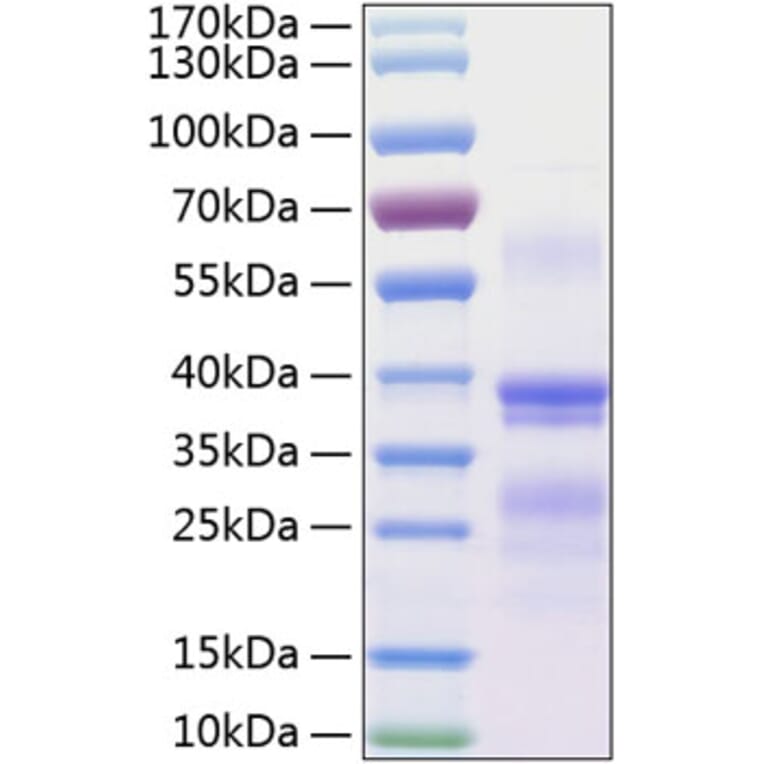 SDS-PAGE - Recombinant Human Repulsive Guidance Molecule A Protein (C-terminal His Tag) (A331219) - Antibodies.com