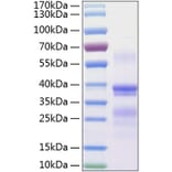 SDS-PAGE - Recombinant Human Repulsive Guidance Molecule A Protein (C-terminal His Tag) (A331219) - Antibodies.com