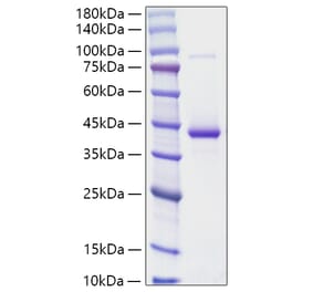 SDS-PAGE - Recombinant Human Resistin Protein (N-terminal Human Fc and His Tag) (A331221) - Antibodies.com