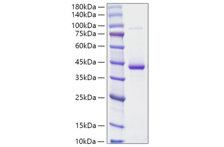 SDS-PAGE - Recombinant Human Resistin Protein (N-terminal Human Fc and His Tag) (A331221) - Antibodies.com