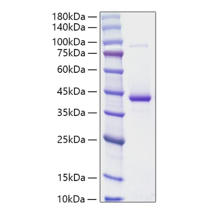 SDS-PAGE - Recombinant Human Resistin Protein (N-terminal Human Fc and His Tag) (A331221) - Antibodies.com