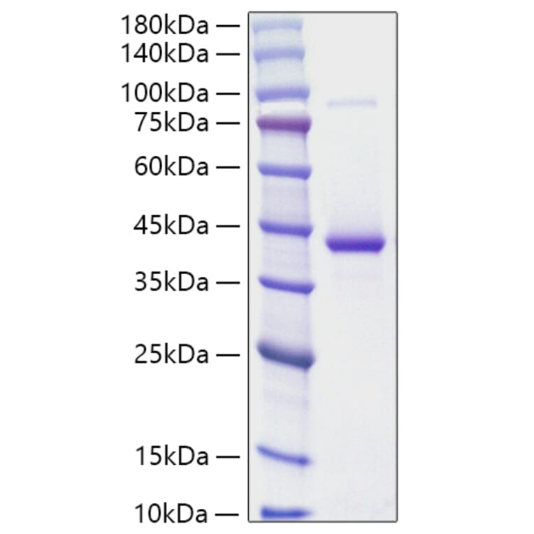 SDS-PAGE - Recombinant Human Resistin Protein (N-terminal Human Fc and His Tag) (A331221) - Antibodies.com