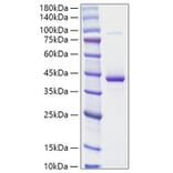 SDS-PAGE - Recombinant Human Resistin Protein (N-terminal Human Fc and His Tag) (A331221) - Antibodies.com