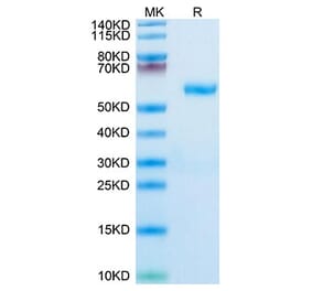 Tris-Bis PAGE - Recombinant Human RNF43 Protein (C-terminal Human Fc Tag) (A331222) - Antibodies.com