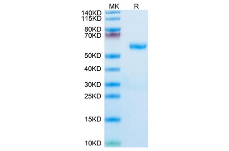 Tris-Bis PAGE - Recombinant Human RNF43 Protein (C-terminal Human Fc Tag) (A331222) - Antibodies.com