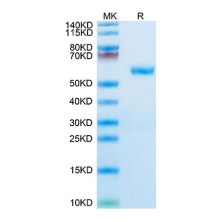 Tris-Bis PAGE - Recombinant Human RNF43 Protein (C-terminal Human Fc Tag) (A331222) - Antibodies.com
