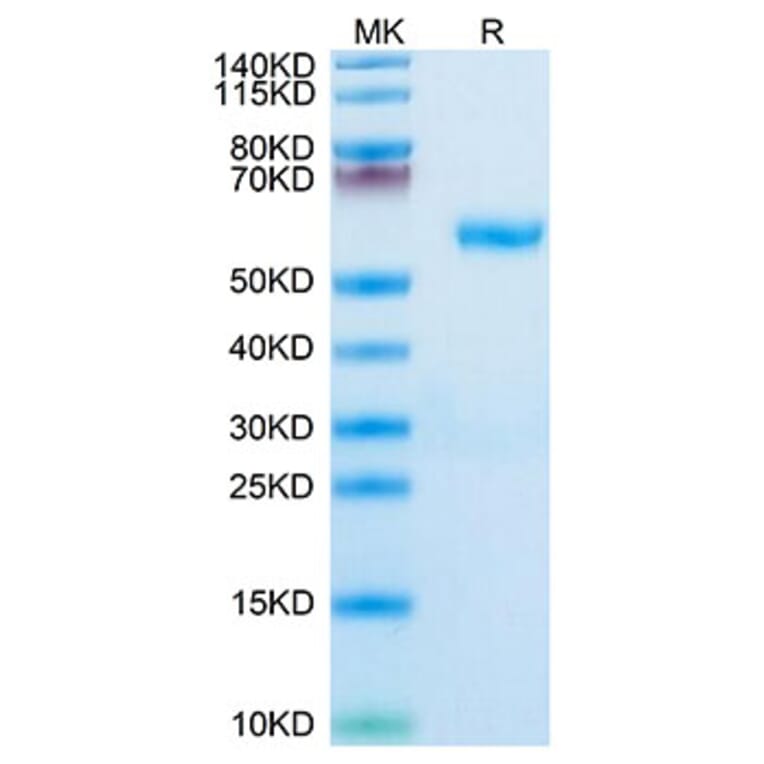 Tris-Bis PAGE - Recombinant Human RNF43 Protein (C-terminal Human Fc Tag) (A331222) - Antibodies.com