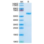 Tris-Bis PAGE - Recombinant Human RNF43 Protein (C-terminal Human Fc Tag) (A331222) - Antibodies.com