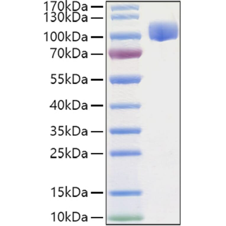 SDS-PAGE - Recombinant Human ROBO4 Protein (C-terminal Human Fc and His Tag) (A331223) - Antibodies.com