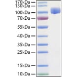 SDS-PAGE - Recombinant Human ROBO4 Protein (C-terminal Human Fc and His Tag) (A331223) - Antibodies.com