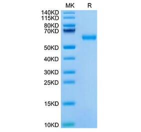 Tris-Bis PAGE - Recombinant Mouse ROR1 Protein (C-terminal His Tag) (A331224) - Antibodies.com