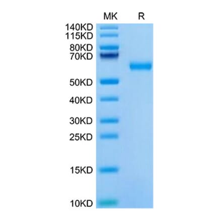 Tris-Bis PAGE - Recombinant Mouse ROR1 Protein (C-terminal His Tag) (A331224) - Antibodies.com