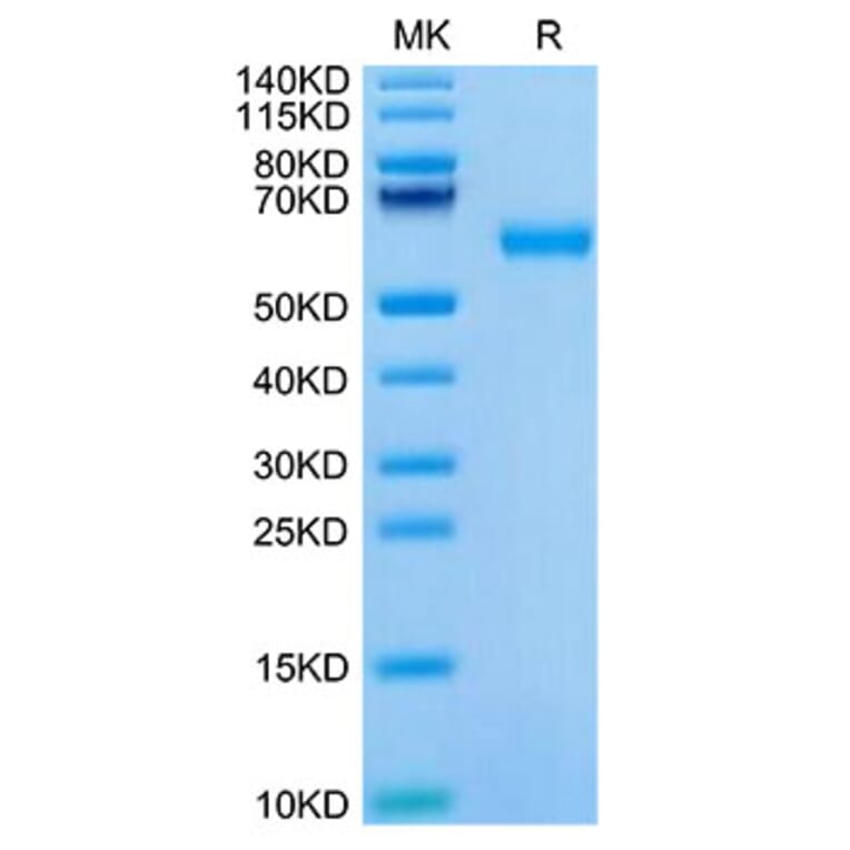 Tris-Bis PAGE - Recombinant Mouse ROR1 Protein (C-terminal His Tag) (A331224) - Antibodies.com