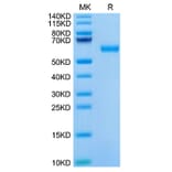 Tris-Bis PAGE - Recombinant Mouse ROR1 Protein (C-terminal His Tag) (A331224) - Antibodies.com