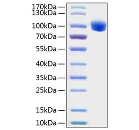 SDS-PAGE - Recombinant Human ROR1 Protein (C-terminal Human Fc and His Tag) (A331225) - Antibodies.com