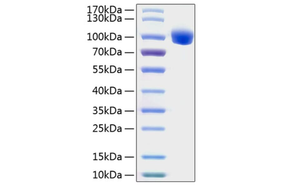 SDS-PAGE - Recombinant Human ROR1 Protein (C-terminal Human Fc and His Tag) (A331225) - Antibodies.com