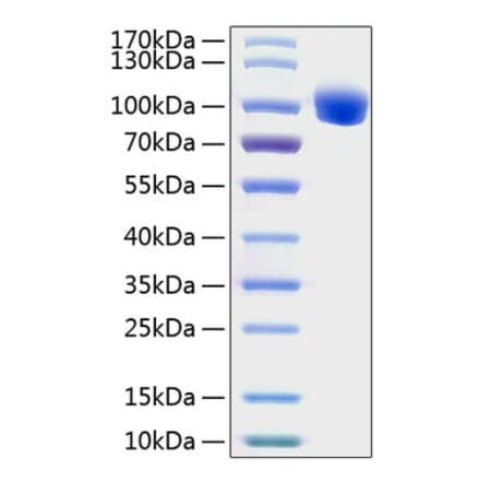SDS-PAGE - Recombinant Human ROR1 Protein (C-terminal Human Fc and His Tag) (A331225) - Antibodies.com