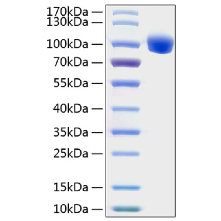 SDS-PAGE - Recombinant Human ROR1 Protein (C-terminal Human Fc and His Tag) (A331225) - Antibodies.com