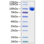 SDS-PAGE - Recombinant Human ROR1 Protein (C-terminal Human Fc and His Tag) (A331225) - Antibodies.com