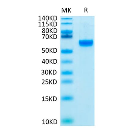 Tris-Bis PAGE - Recombinant Human ROR2 Protein (Biotin) (C-terminal His and Avi Tag) (A331226) - Antibodies.com