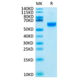 Tris-Bis PAGE - Recombinant Human ROR2 Protein (Biotin) (C-terminal His and Avi Tag) (A331226) - Antibodies.com