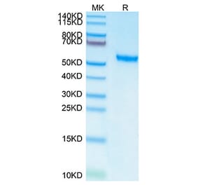 Tris-Bis PAGE - Recombinant Human ROR2 Protein (C-terminal His and Avi Tag) (A331227) - Antibodies.com