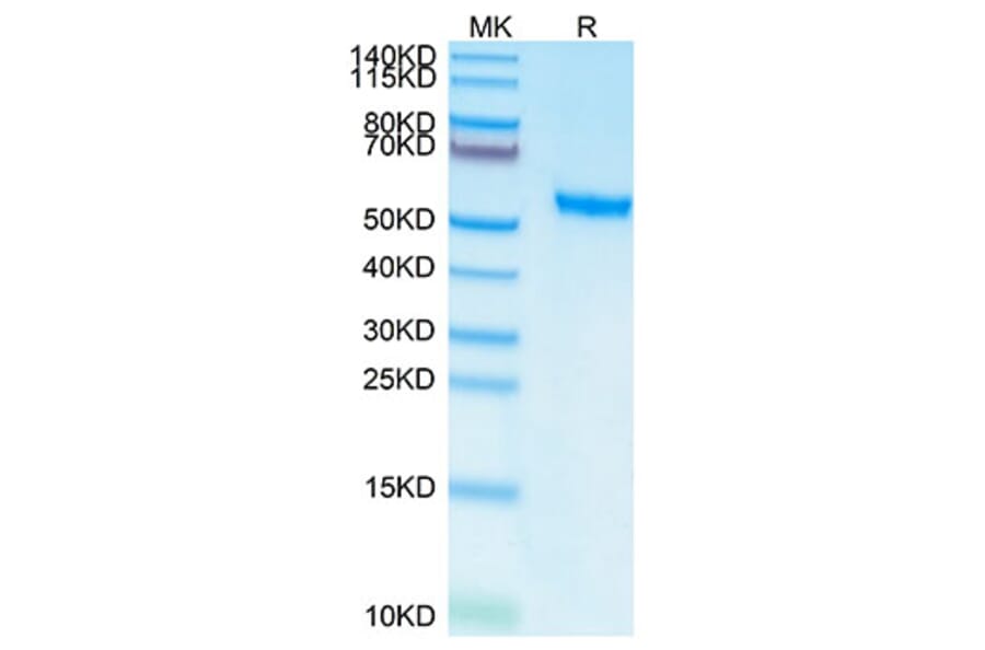 Tris-Bis PAGE - Recombinant Human ROR2 Protein (C-terminal His and Avi Tag) (A331227) - Antibodies.com
